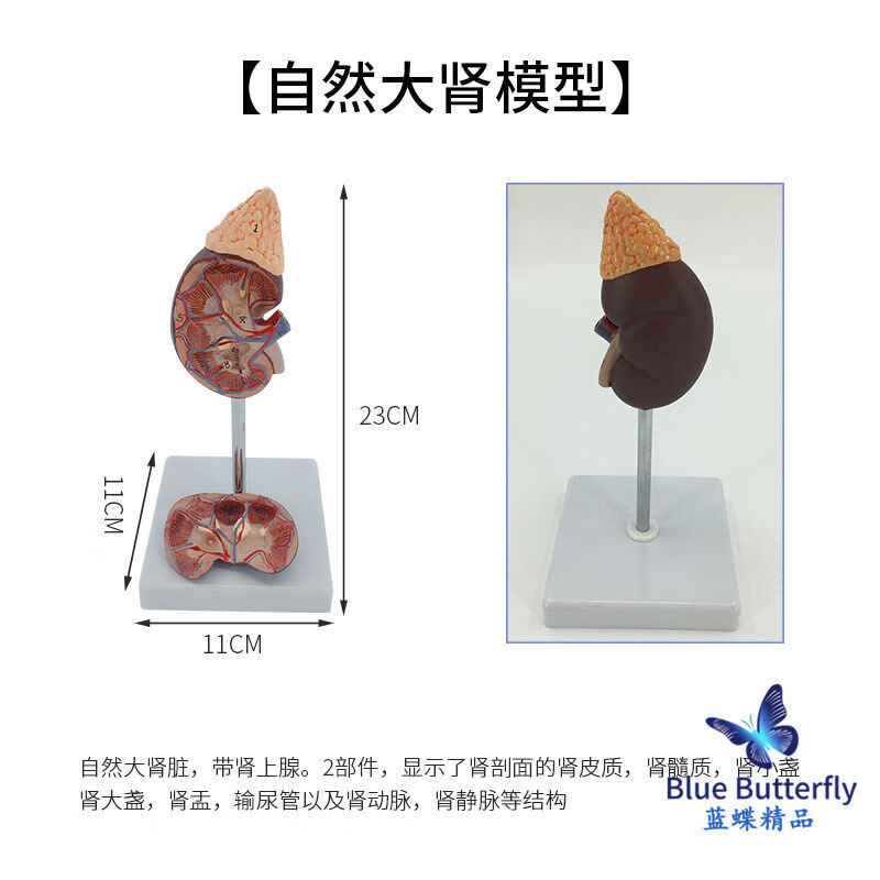 人体肾脏解剖放大模型 肾脏切面解剖模型 肾上腺 肾脏结构模型 自然大