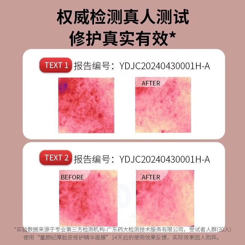 童颜纪童颜纪厚脸皮修护面膜敏感肌可用保湿补水淡化细纹收缩毛孔20片装 【一包20片】厚脸皮面膜