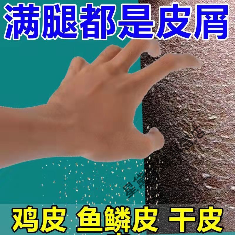 情绪波动导致皮肤起鸡皮(为什么说情绪会影响皮肤状态) 情绪波动导致皮肤起鸡皮(为什么说情绪会影响皮肤状态)