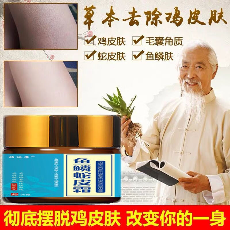 顽达康鸡皮鱼鳞皮肤霜鱼鳞蛇皮肤保湿美l白蛇皮肤干燥纹路腿上鱼鳞脱