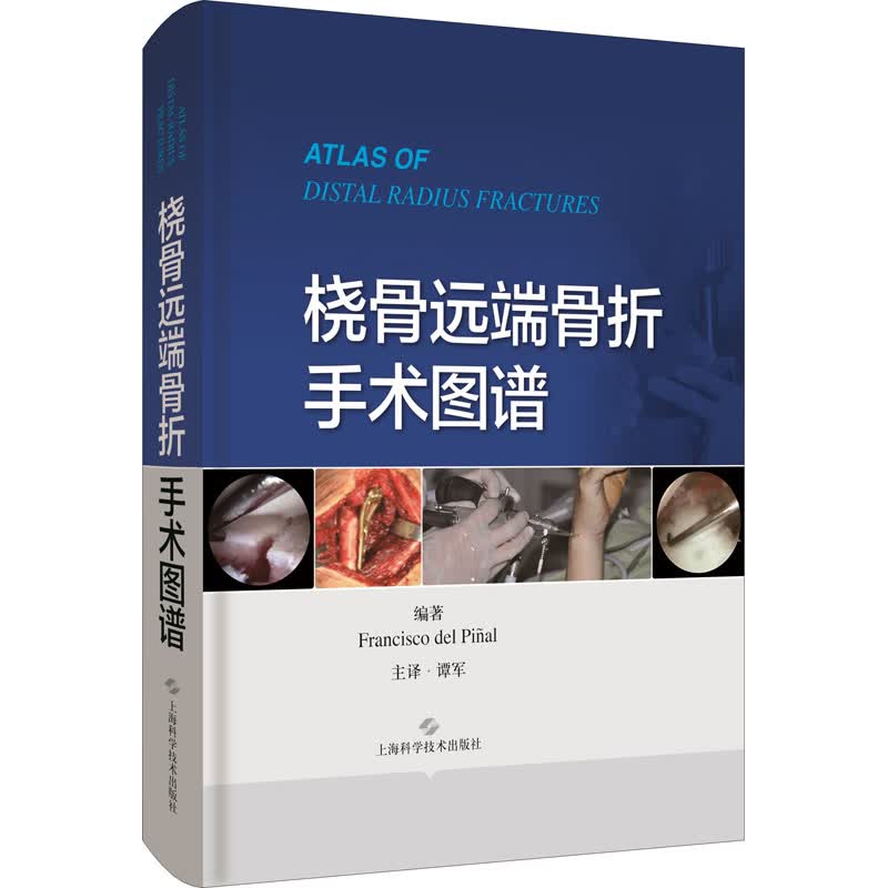 桡骨远端骨折手术图谱