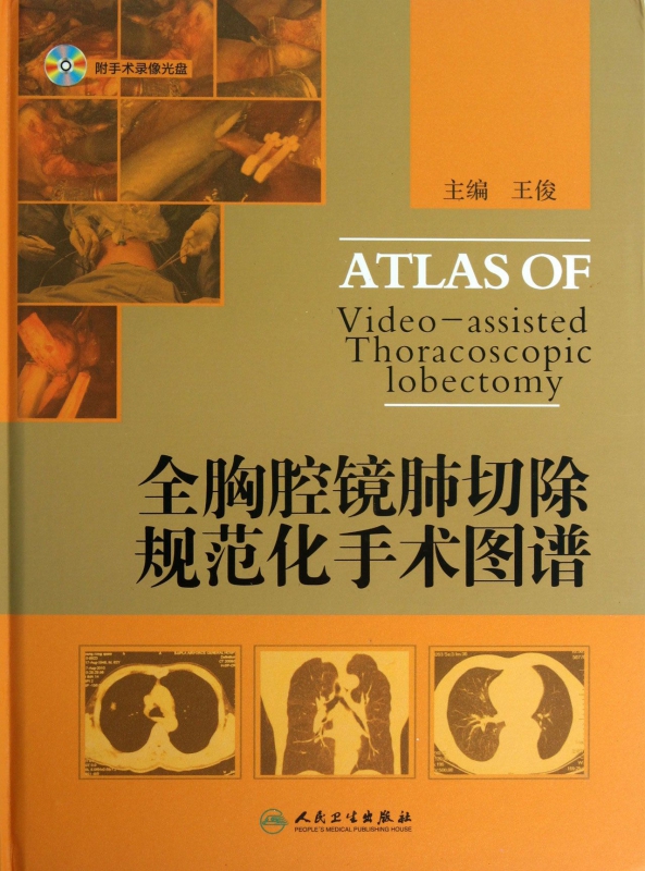 全胸腔镜肺切除规范化手术图谱(附光盘)(精)