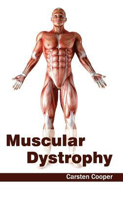 预订Muscular Dystrophy