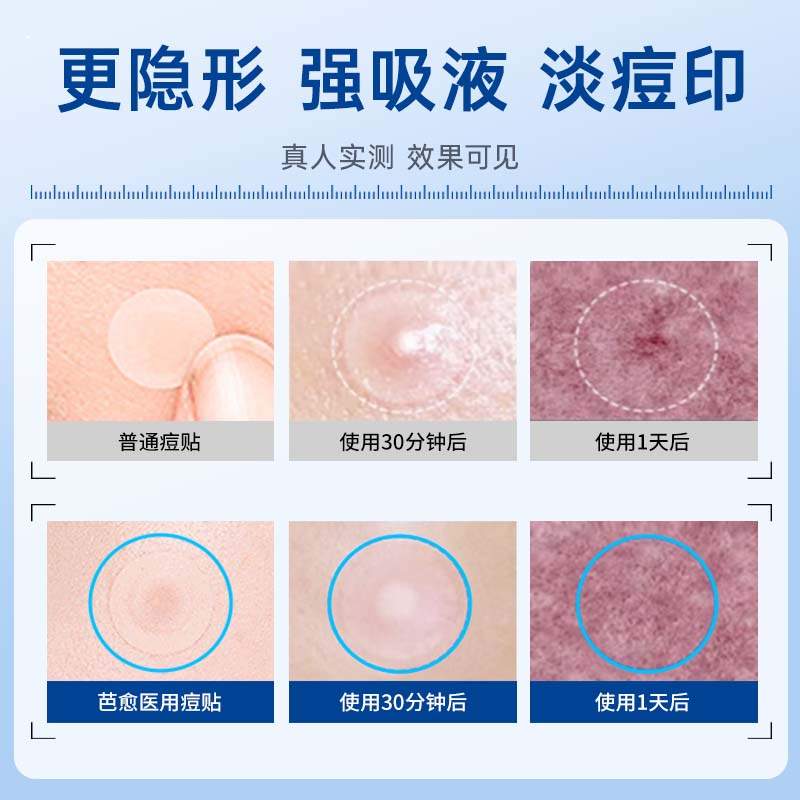 芭愈医用痤疮防疤贴 预防痘印痘坑痘痘贴 轻薄遮瑕上妆 舒缓防疤 【一盒装】28贴