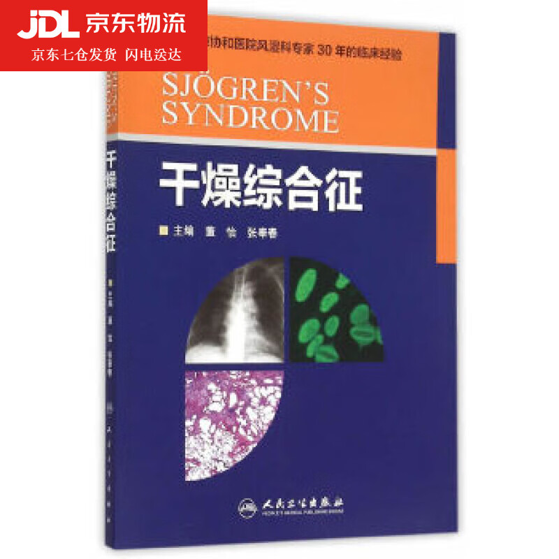 干燥综合征 董怡,张奉春主编 97871