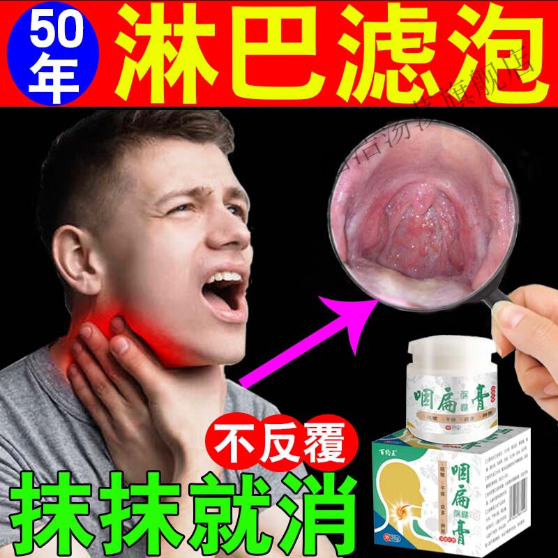 咽喉舌根咽后壁淋巴滤泡增生声带扁桃体肥大发l炎异物感咽焱膏箹