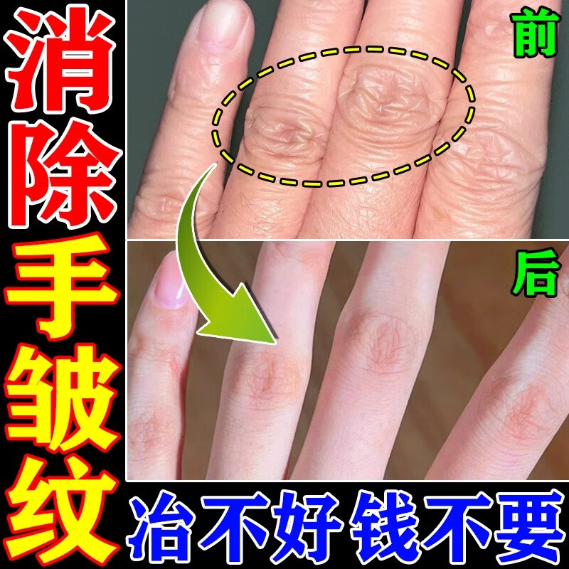 凡士林去手指关节皱纹手背暗沉粗糙干燥修护修复嫩肤祛除手纹手足滋润