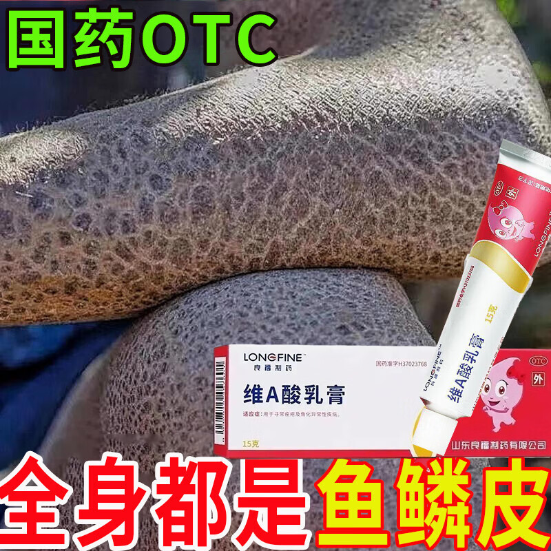 鱼鳞皮肤专用药图片