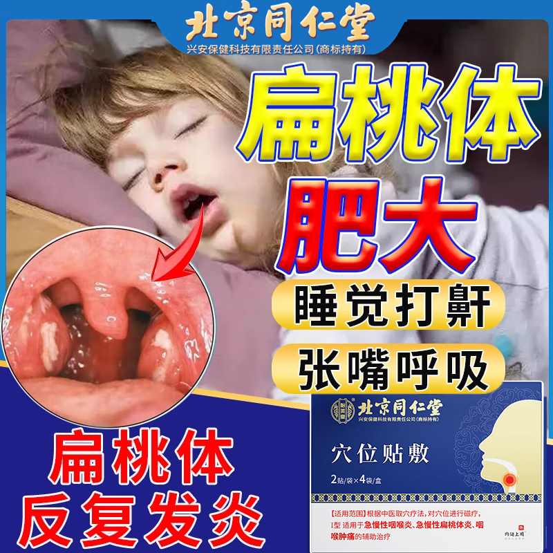 扁桃体肥大可搭特效中药贴儿童张嘴呼吸喉咙发炎咽喉肿痛扁桃体炎肥大