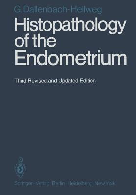 预订histopathology of the endometrium (softcover rep