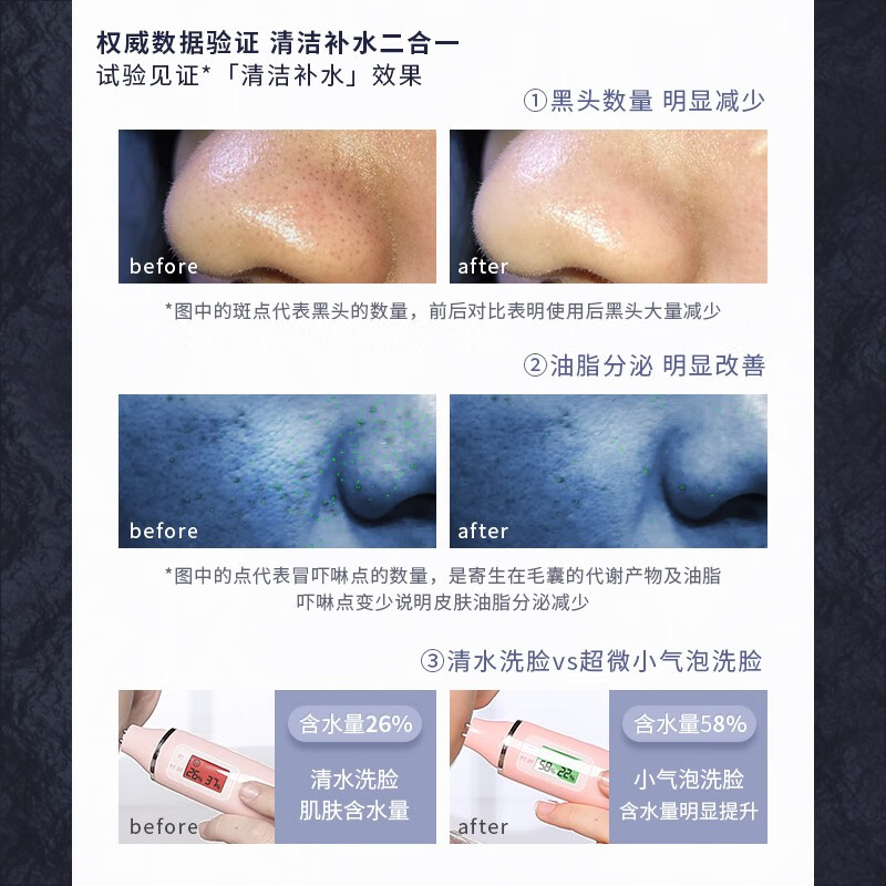 俪人邦小气泡美容仪器脸部吸黑头仪器毛孔深层清洁仪补水仪家用面部电动去黑头粉刺神器去黑头仪器 标准版 9代-双头款(吸黑头+注氧)晒图奖励
