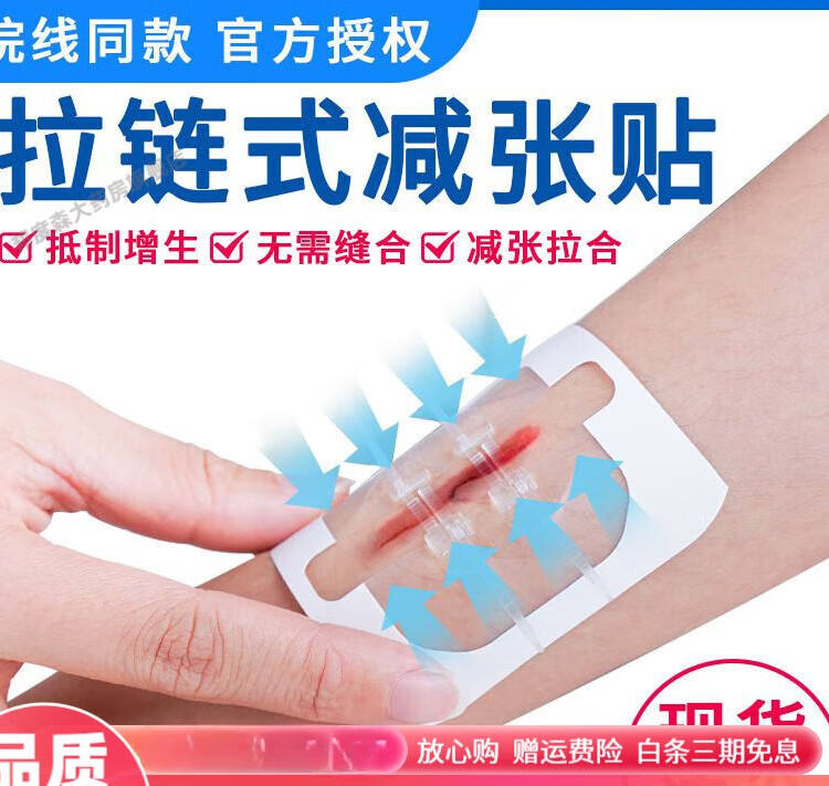 张力贴 拉链式伤口愈合贴免缝长肉减张器术后皮肤伤口缝合疤痕创口贴