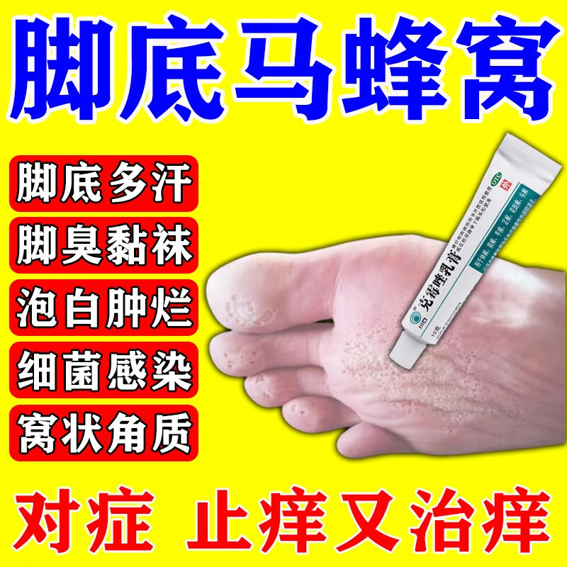 脚治足癣脚气药克霉唑乳膏 5盒【脚底板蜂窝状糜烂疼痛 走不成路】