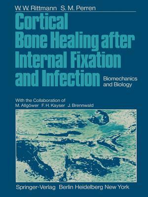 预订 cortical bone healing after internal fixation a
