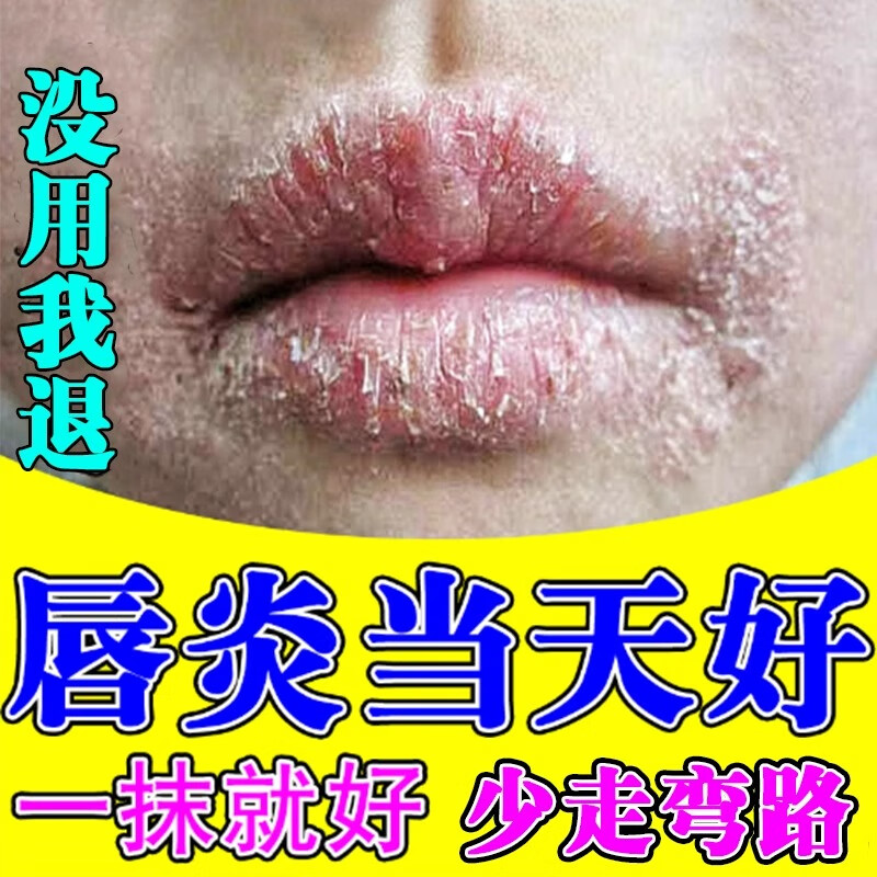 用唇膏嘴起皮(用唇膏嘴唇起皮)