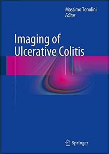 预订imaging of ulcerative colitis