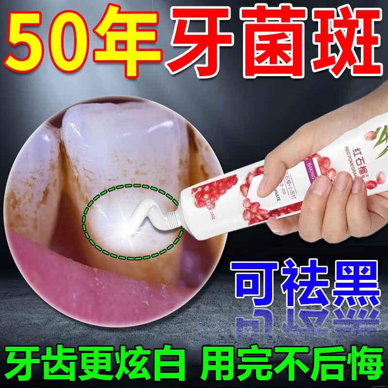 牙菌斑去除儿童牙齿美白神器牙垢牙渍去黄去口臭口腔异味牙齿黑斑 单