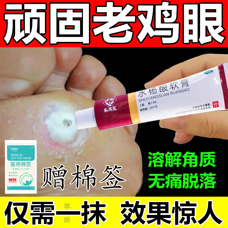 无痛脱落成人去脚底老茧去硬皮刺猴脚鸡眼发货特效i率药贴水杨酸软膏