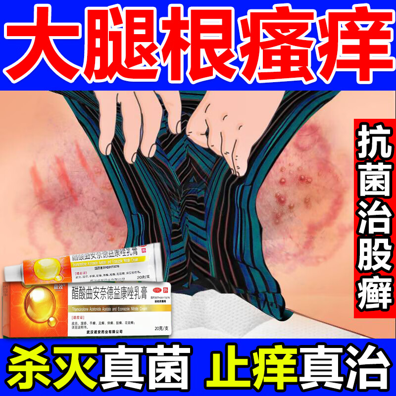 潮湿瘙痒小疙瘩股癣专用otc药股藓大腿内侧 真菌感染皮肤用药抗真菌