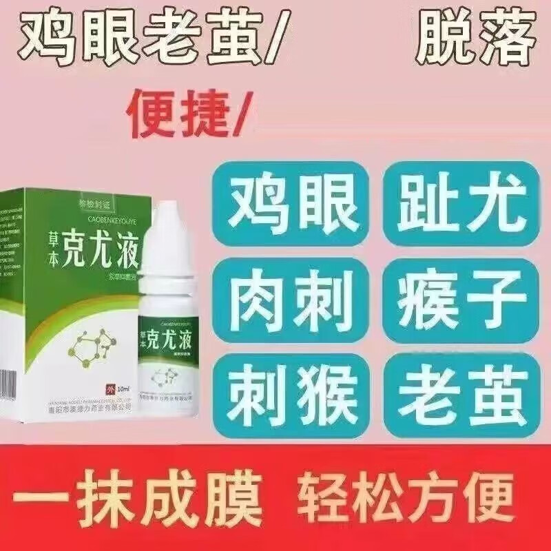 【大京药房直发】扁平疣鸡眼水肉粒液辅助非专用点猴子去脚趾手指鸡眼