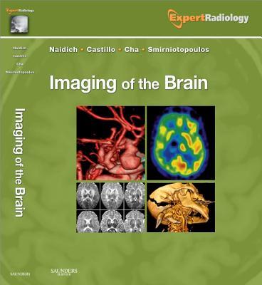 预订Imaging of the Brain: Expert Radiology Series