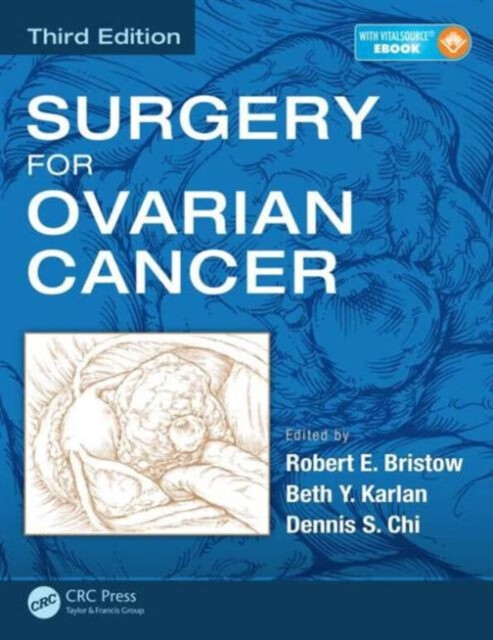 预订 surgery for ovarian cancer, third edition