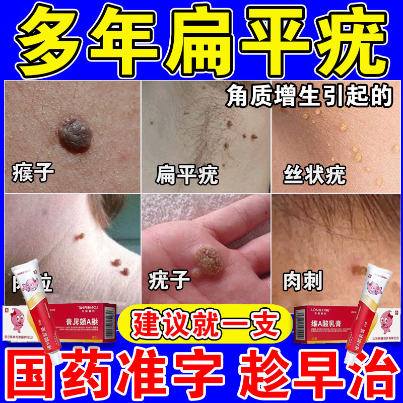 扁平疣专用otc药膏 去疣灵扁平疣面部专用脖子瘊子小肉