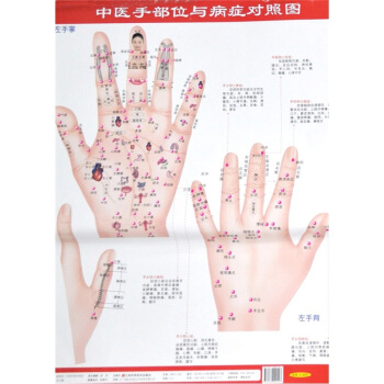 中医手部位与病症对照图【正版图书,放心购买】