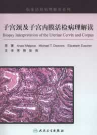 子宫颈及子宫内膜活检病理解读