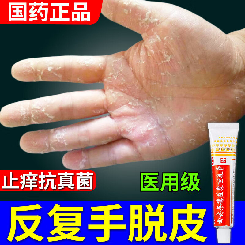15g 手脱皮用什么药手脱皮膏真菌感染手皮开裂干裂手癣真菌感染药膏