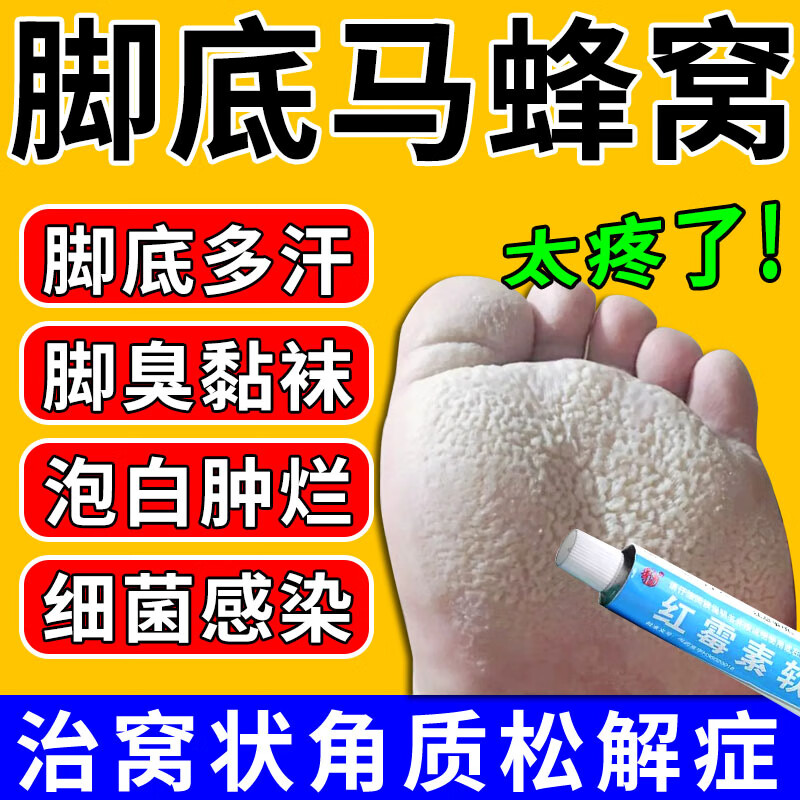 窝状角质松解症脚底发白脱皮水泡糜烂 脚底蜂窝状小孔脚臭脚汗沙虫脚
