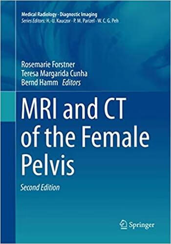预订MRI and CT of the Female Pelvis