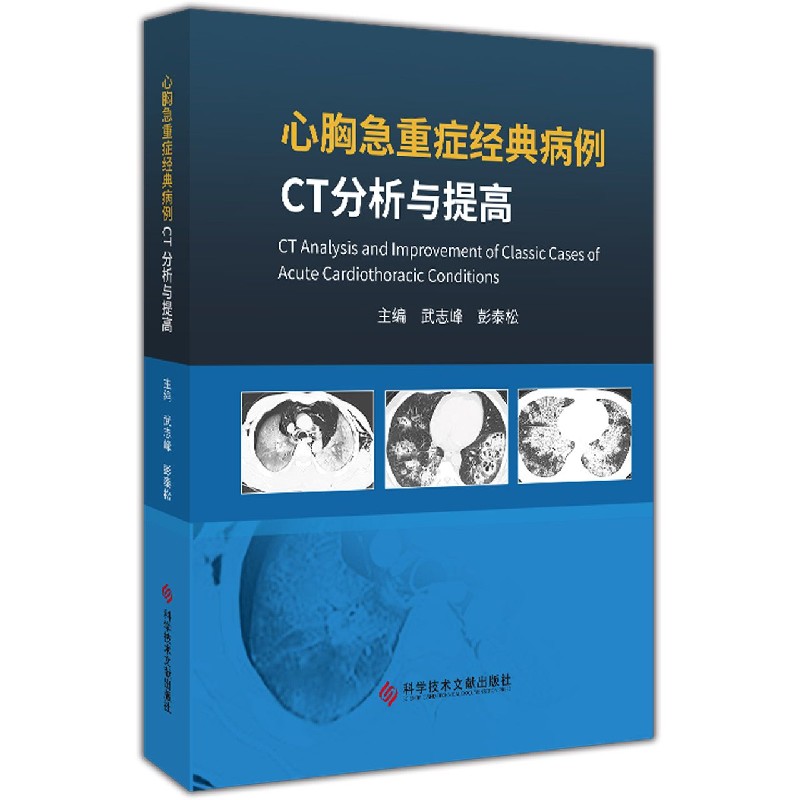 心胸急重症经典病例CT分析与提高(精)