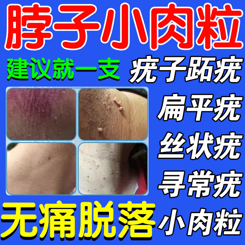维a酸乳膏 治扁平疣用药膏面部脖子 去瘊子肉粒疙瘩 除小肉粒猴子痤疮