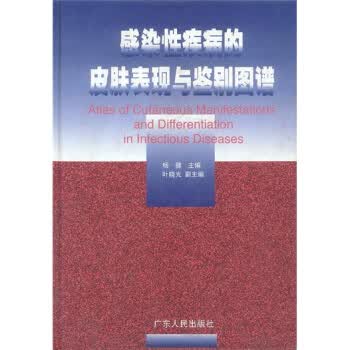 感染性疾病的皮肤表现与鉴别图谱【正版图书】