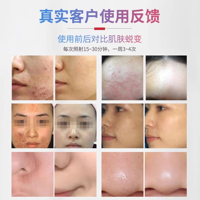 SHENDIAO光谱仪美容仪器家用脸部红蓝光痘面罩美容院专用光子仪彩光 七色光谱仪带喷雾