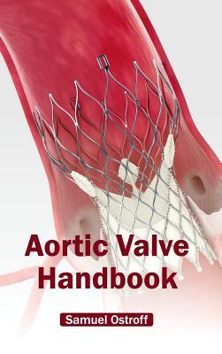 预订Aortic Valve Handbook