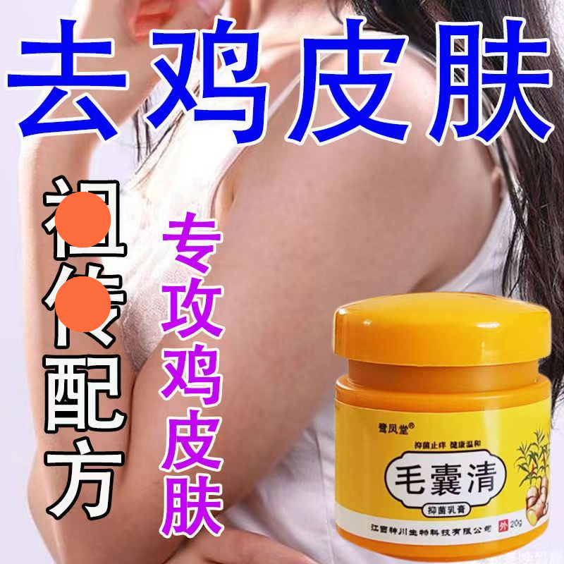 怎么去鱼鳞斑和鸡皮疙瘩(怎么去鱼鳞斑和鸡皮疙瘩的小妙招) 怎么去鱼鳞斑和鸡皮疙瘩(怎么去鱼鳞斑和鸡皮疙瘩的小妙招)