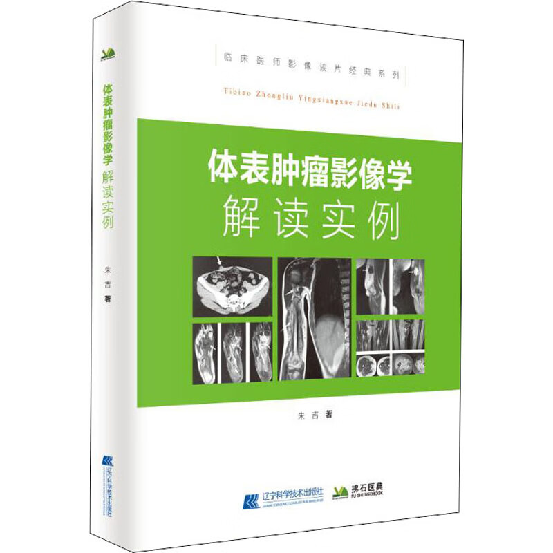 体表肿瘤影像学解读实例
