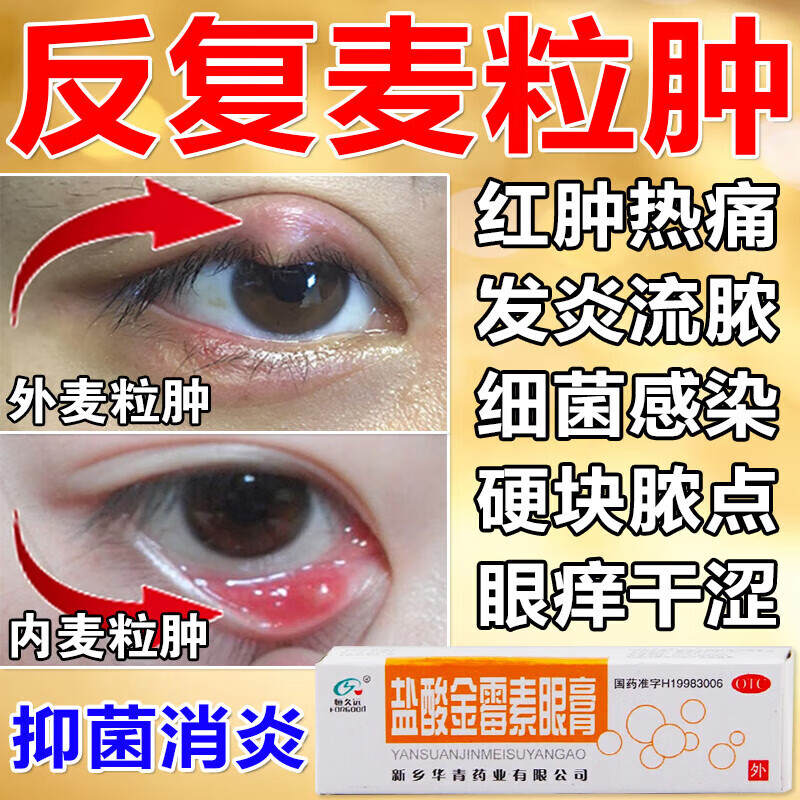 麦粒肿眼膏内外麦粒肿眼睛红肿刺痛细菌感染眼睑炎沙眼治麦粒肿针眼撅