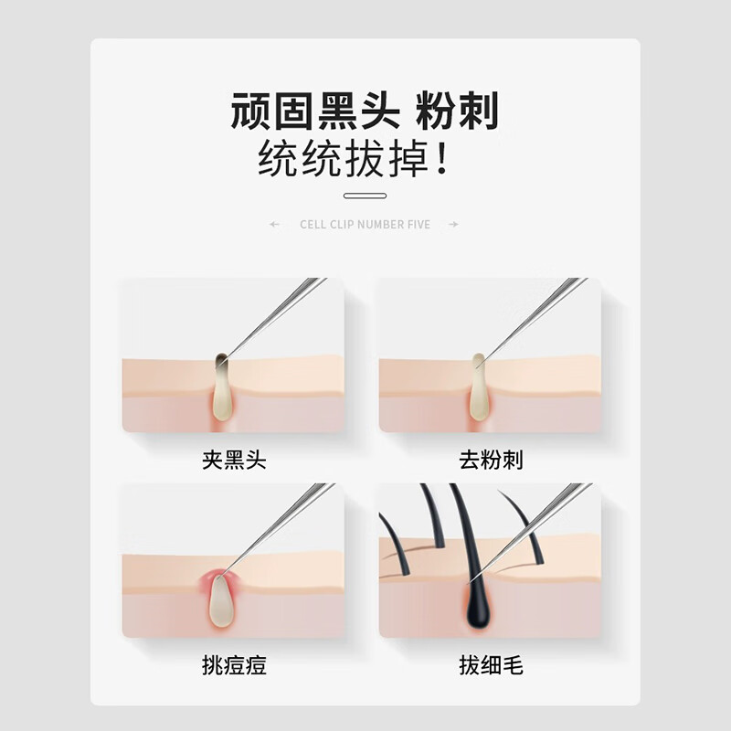 海菲诺细胞夹粉刺针套装黑头夹镊子去黑头痘痘针粉刺清洁工具 超尖细胞夹尖嘴 5件