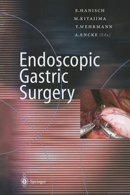 预订endoscopic gastric surgery