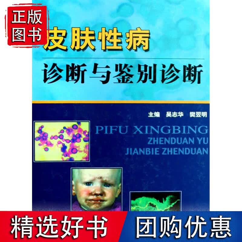 皮肤性病诊断与鉴别诊断