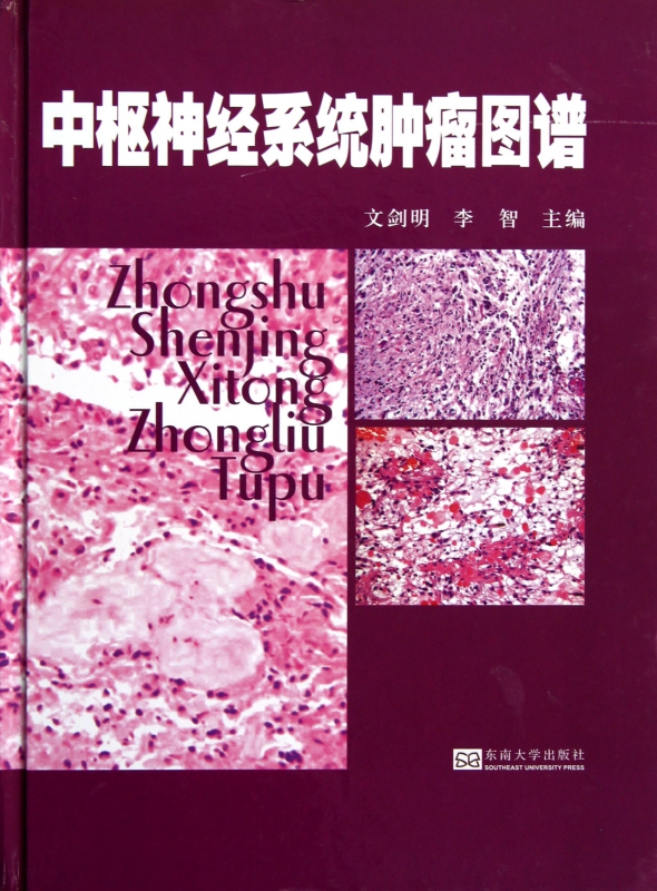 中枢神经系统肿瘤图谱(精)