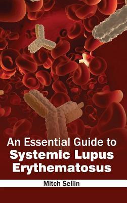 预订essential guide to systemic lupus erythematosus