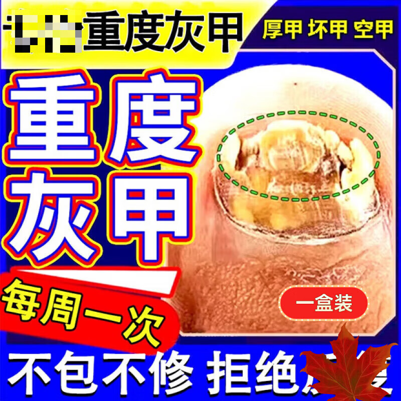 灰指甲特筱药第1名阿莫罗芬亮甲一滴甲真菌感染脱甲坏甲抑菌液 1盒