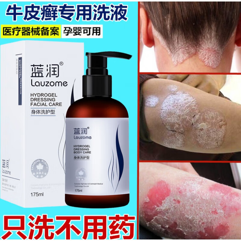 牛皮癣沐浴露 专中浴软膏老偏方泡澡沐浴露洗发水