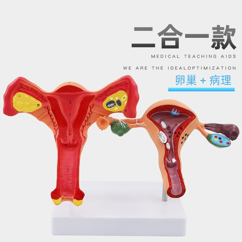 facemini 人体女性生殖子宫解剖病理模型 阴道卵巢教学模型 妇科生殖