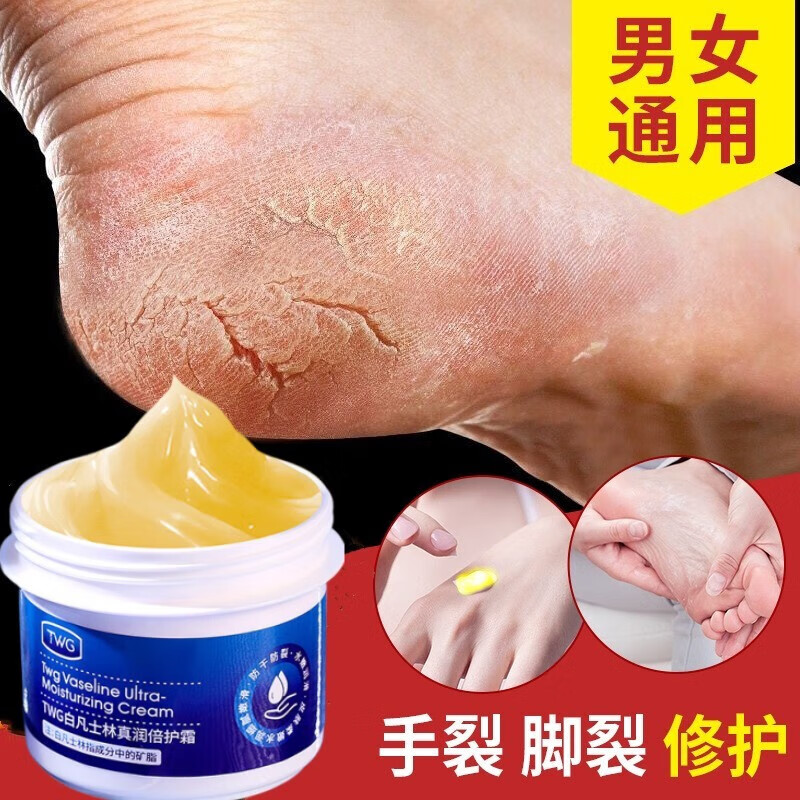 白里透红脚后跟干裂防治手脚脱皮开裂真菌感染 1盒装