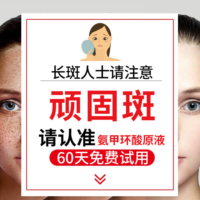【医I美院线】氨甲环酸精华液传明酸湿敷注射液黄褐斑美白祛斑提亮肤色改善暗沉补水保湿烟酰胺原液小白瓶O 三瓶装【溶斑油不反黑】